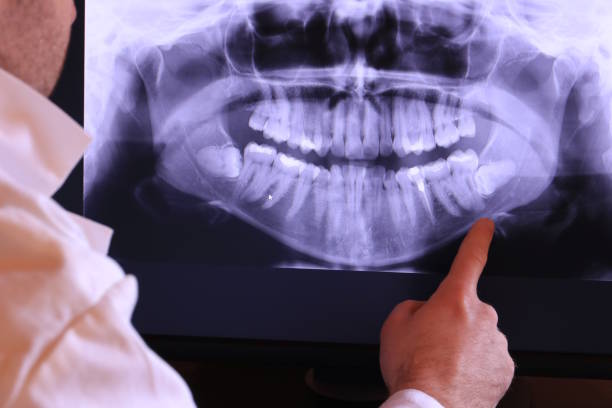 Best Emergency Treatment for Toothache in Rockland, ME